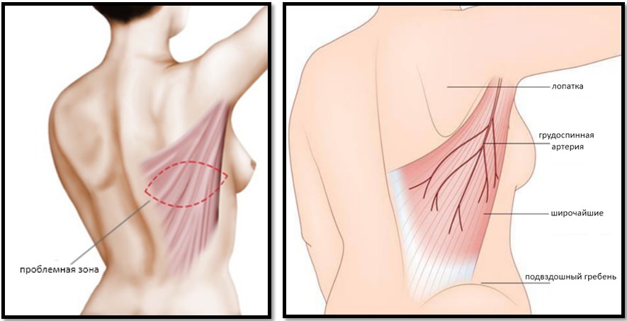 Анатомия спины, широчайшие мышцы спины 
