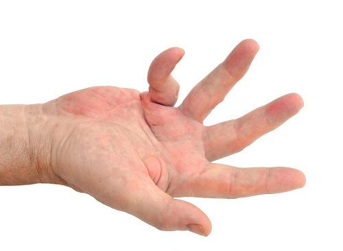 Скрюченный палец