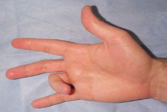 Гимнастика пальцев